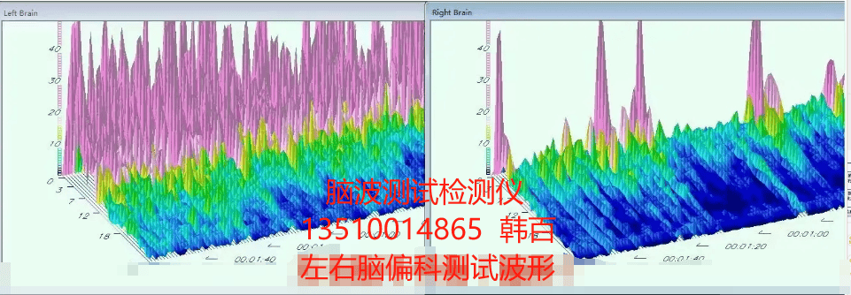 凯发国际天生赢家2024年黑科技韩国多元NeuroHarmony脑波测试检测仪-